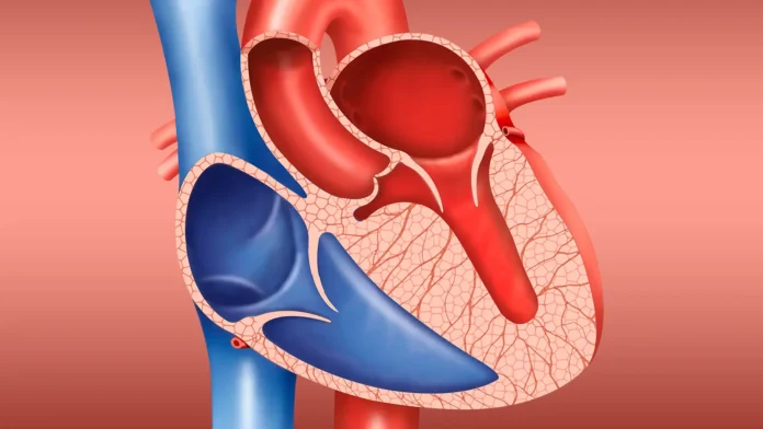 A computer rendering of hypertrophic cardiomyopathy.