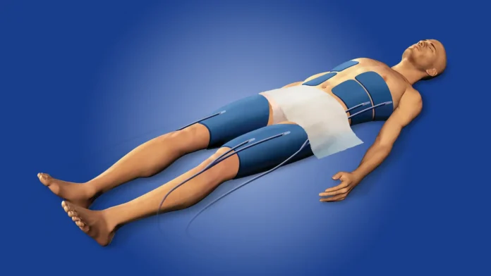 Longer Therapeutic Cooling Comes Up Short After Cardiac Arrest A computer rendering of a man receiving therapeutic hypothermia.