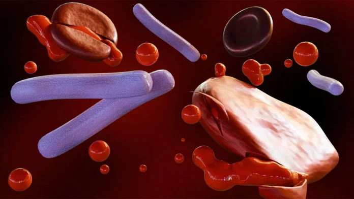 Two Symptoms Linked to Antibiotic Delays in Presumed Sepsis A computer rendering of sepsis bacteria in the blood.